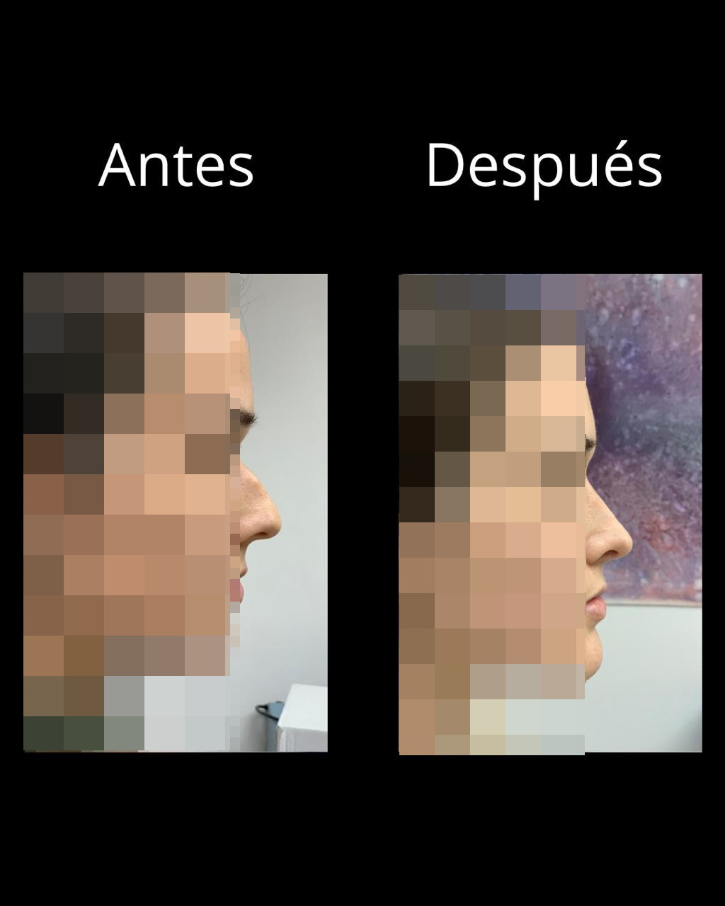 Antes
