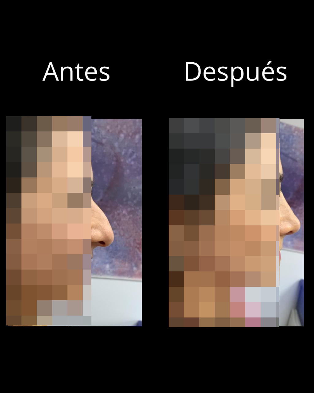 Antes